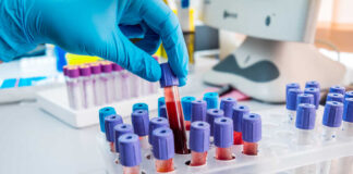 A gloved hand placing a blood sample tube into a rack