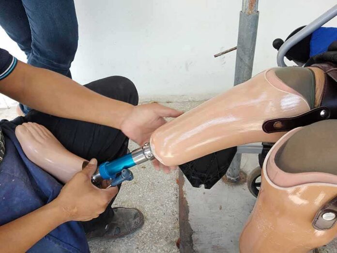 Technician adjusting a prosthetic leg on a seated person